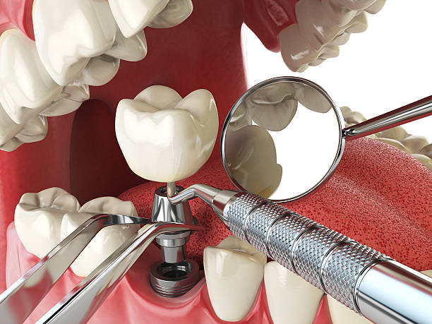 Best Emergency Dental Care for Trauma or Injury in Braham, MN